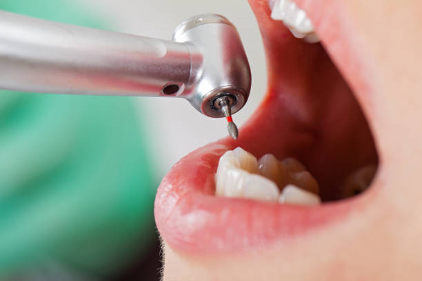Best Weekend Emergency Dentist in Vian, OK